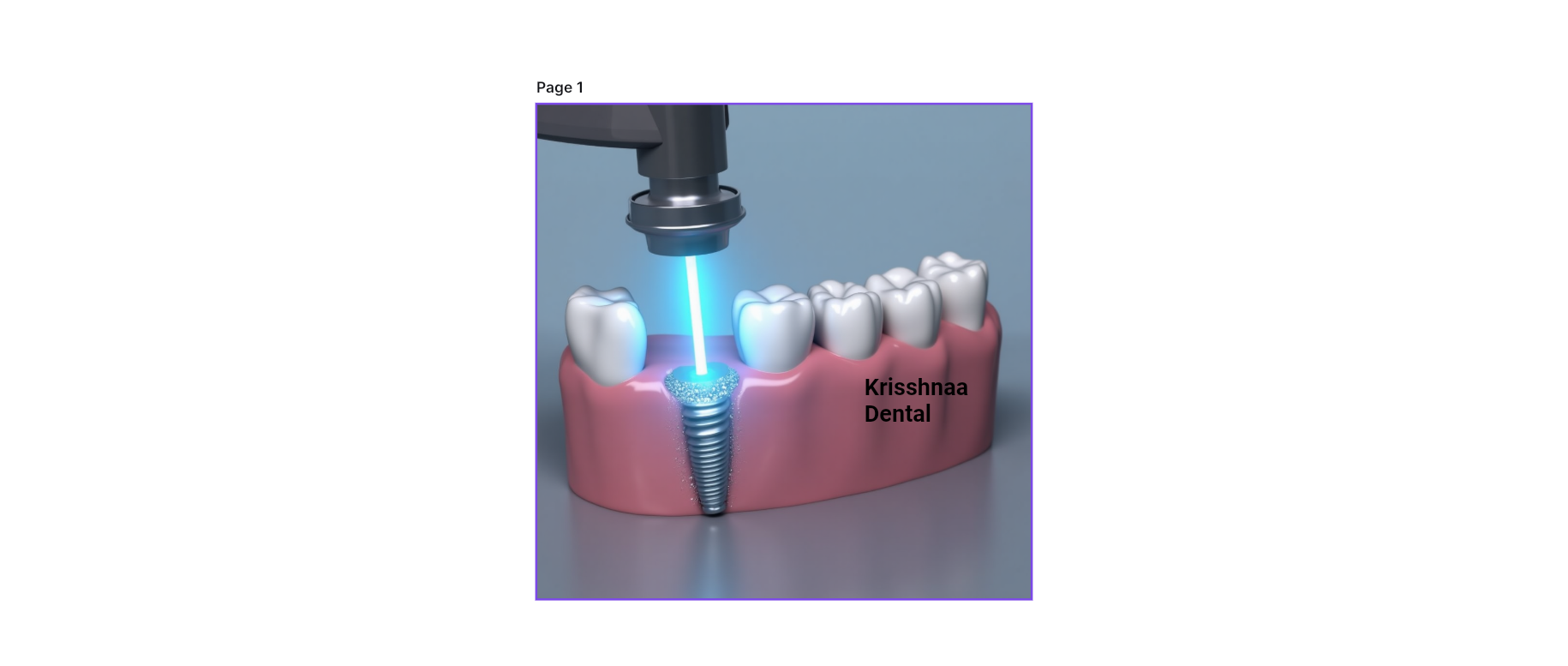 Laser Dentistry in Noida