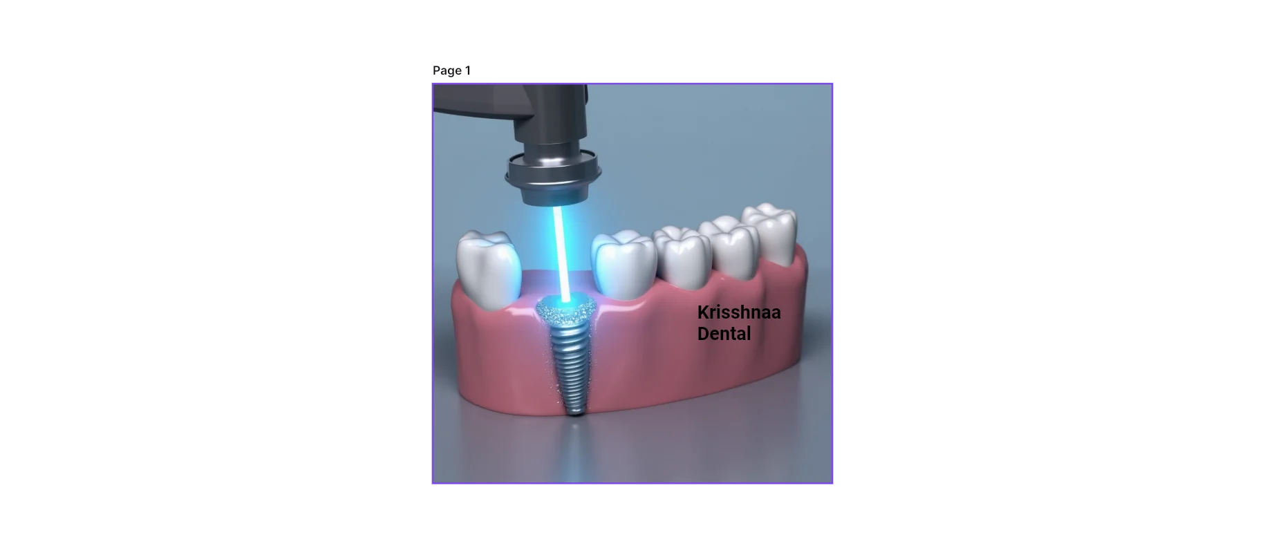 Laser Dentistry in Noida
