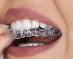 Invisalign & Orthodontics