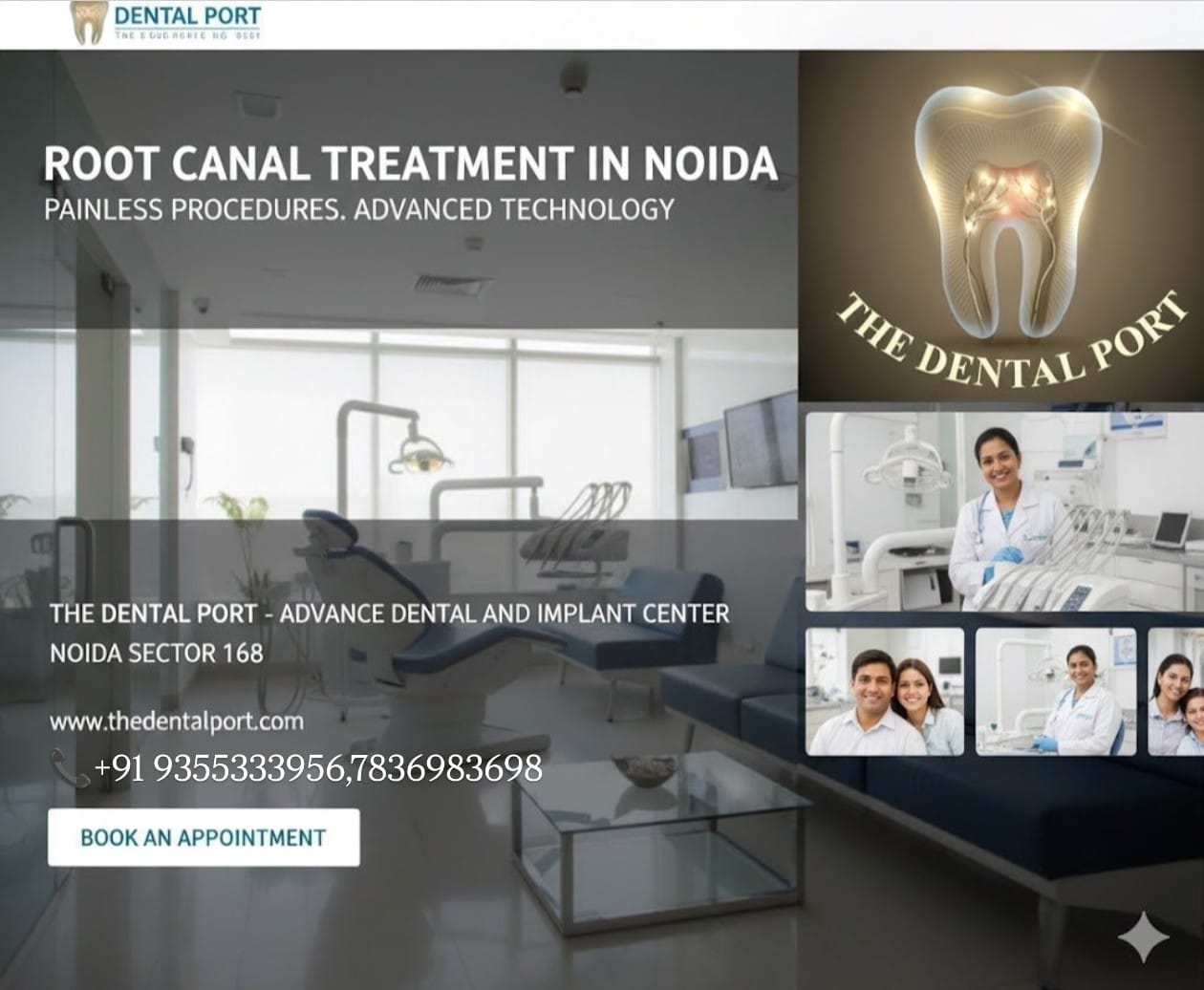 Root Canal Therapy