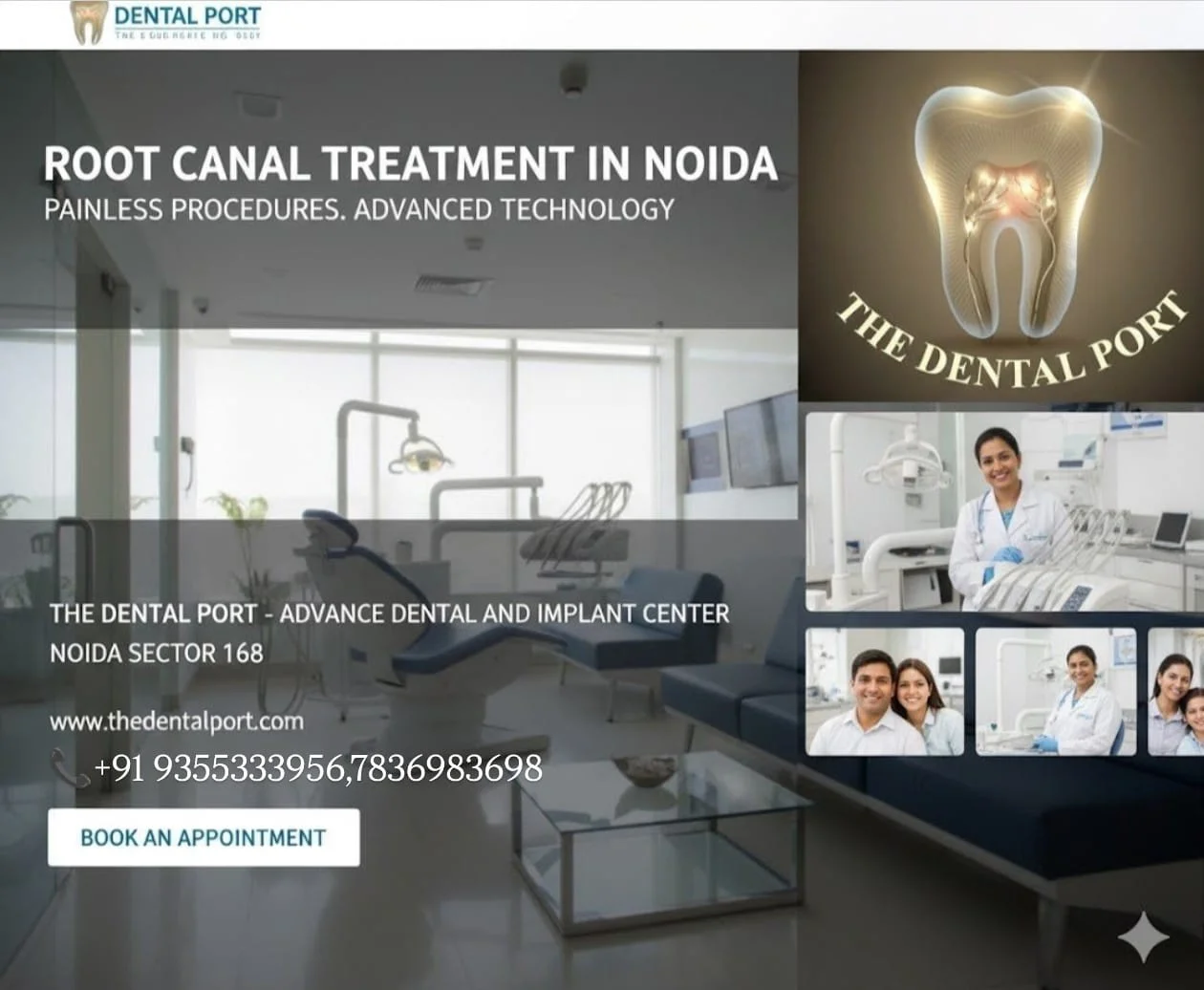 Root Canal Therapy